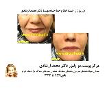بهترین کلینیک زیبایی در پیروزی