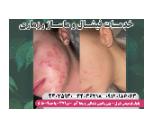 خدمات پاکسازی پوست در بلوار فردوس
