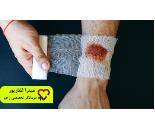 درمانگر زخم دیابتی در منزل در نارمک